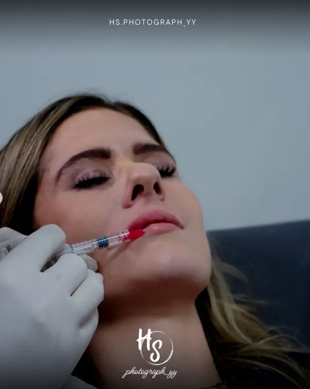Client receiving a facial injection (lip filler) with a syringe held by a doctor.